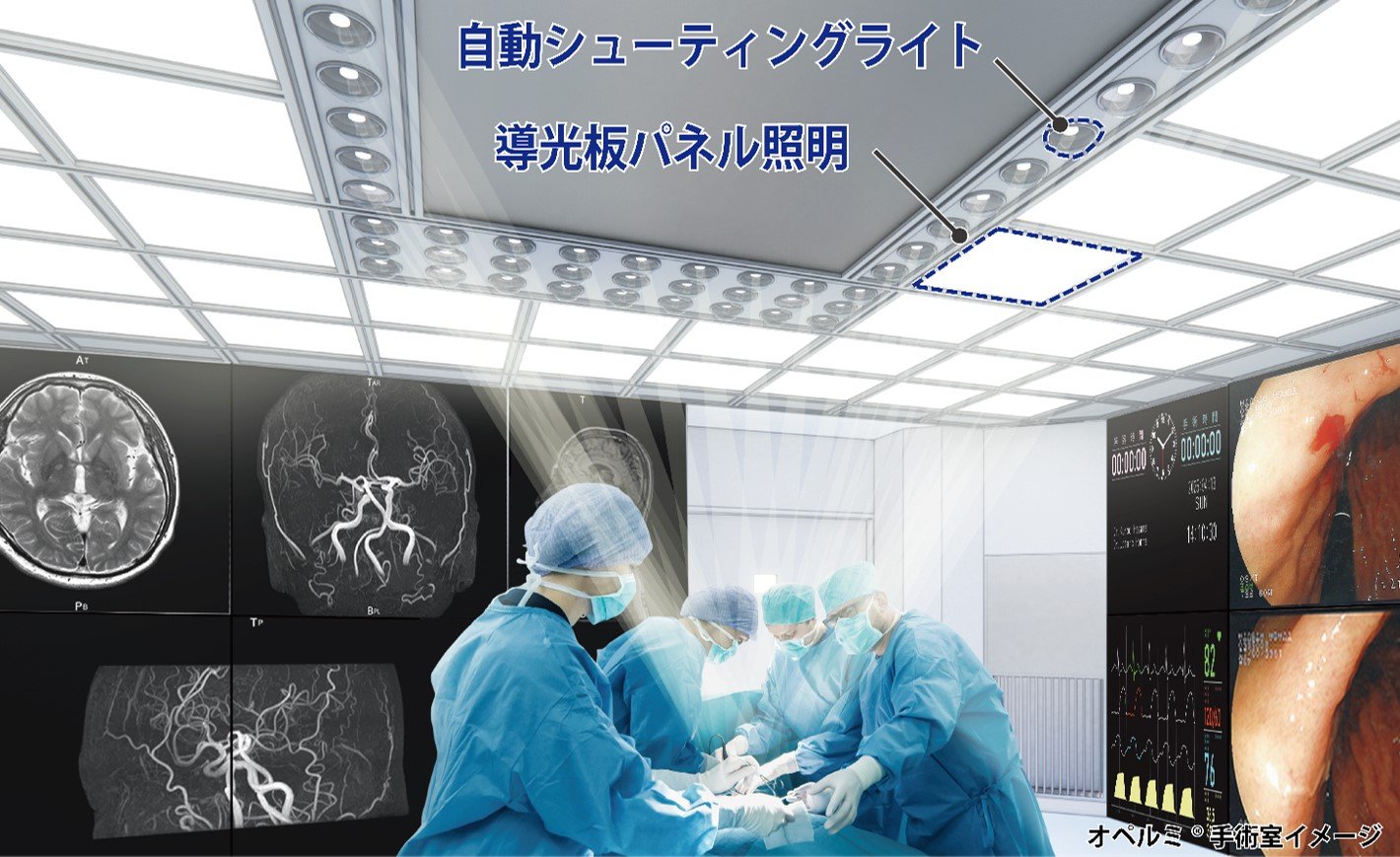 順天堂大学堀教授が天井照明型手術室「オペルミ®」を視察